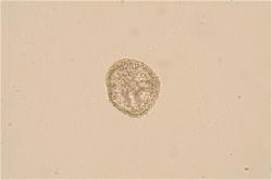 ウニの発生の観察