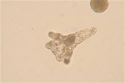 ウニの発生の観察