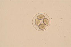 ウニの発生の観察