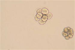 ウニの発生の観察