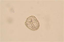 ウニの発生の観察