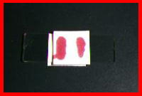 方法5